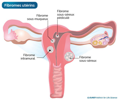Cure Fibrome Décongestion | Infusion 100% naturelle | 21 jours